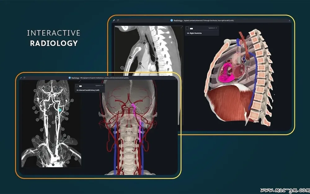 医学三维人体解剖软件 Complete Anatomy v12.6.0 Mac版 For Mac 中文版